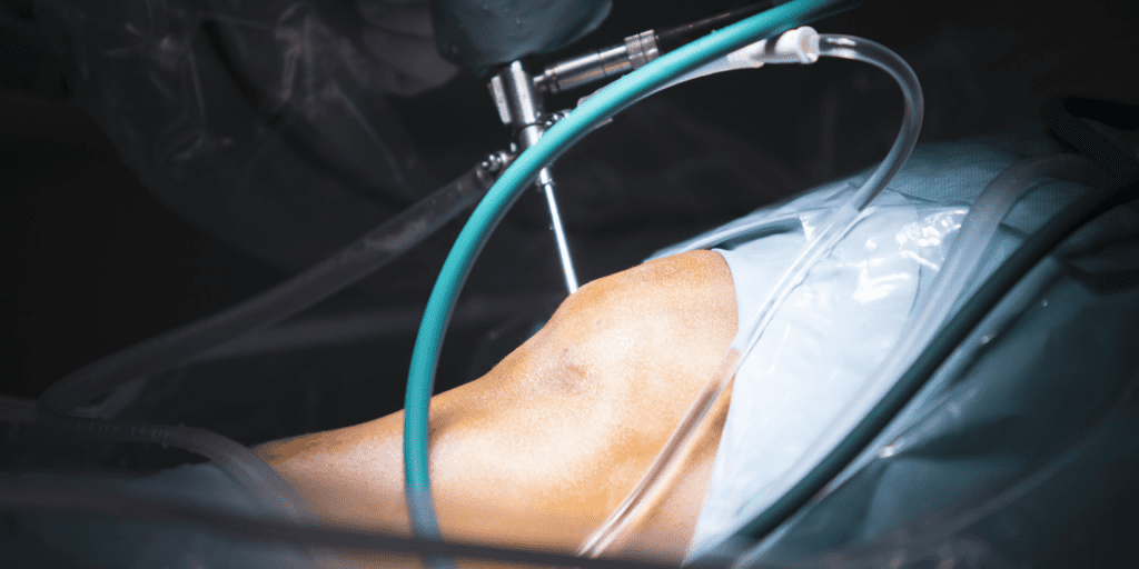 Trauma Surgery Raipur