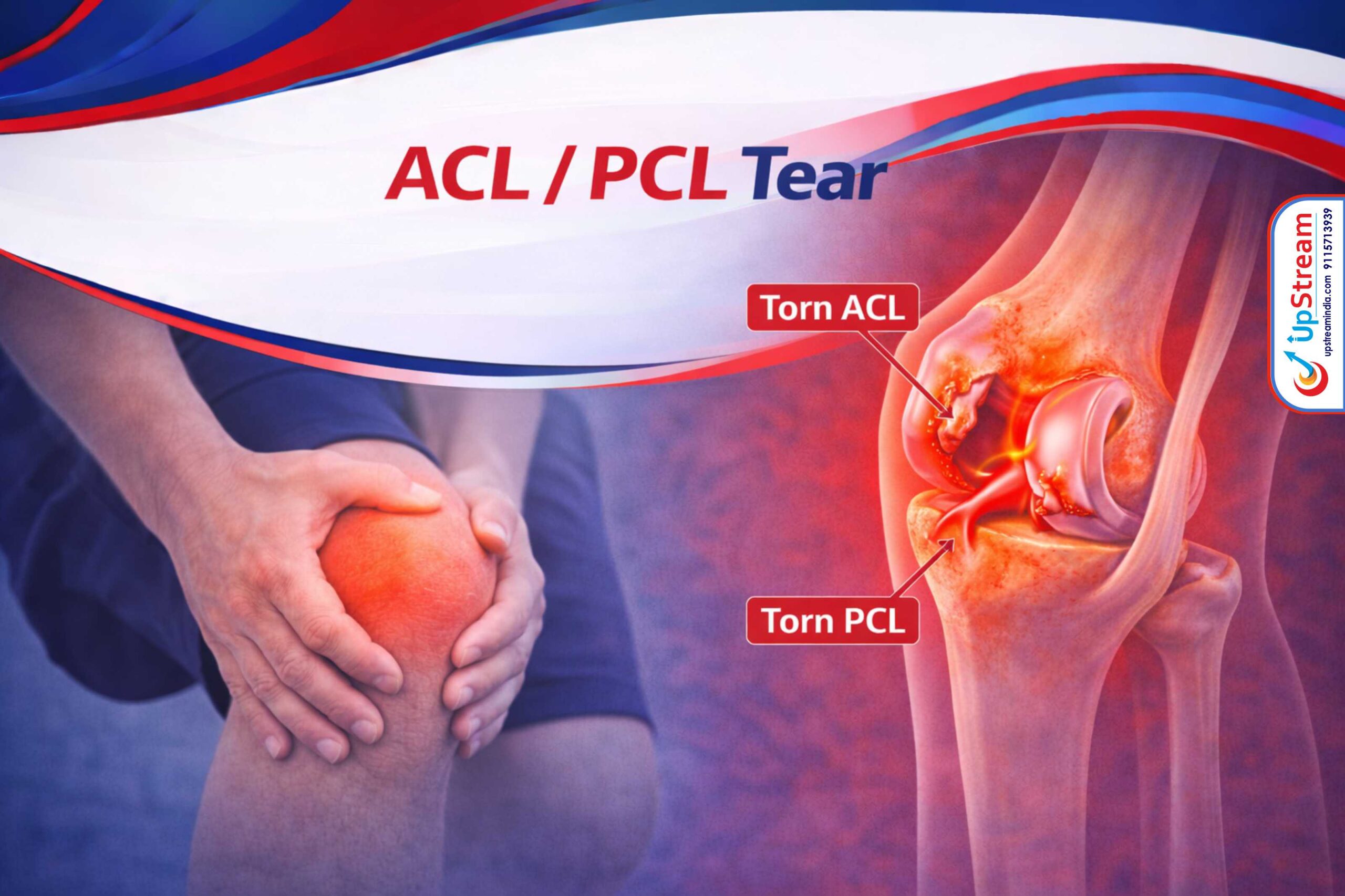 ACL PCL Ligament Tear Treatment in Raipur – Knee Injury Guide