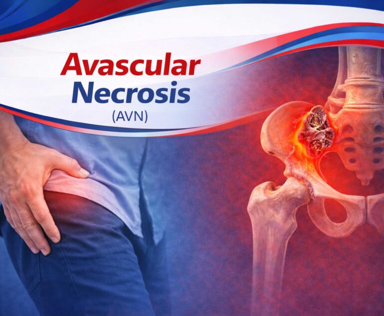 Avascular Necrosis Treatment in Raipur