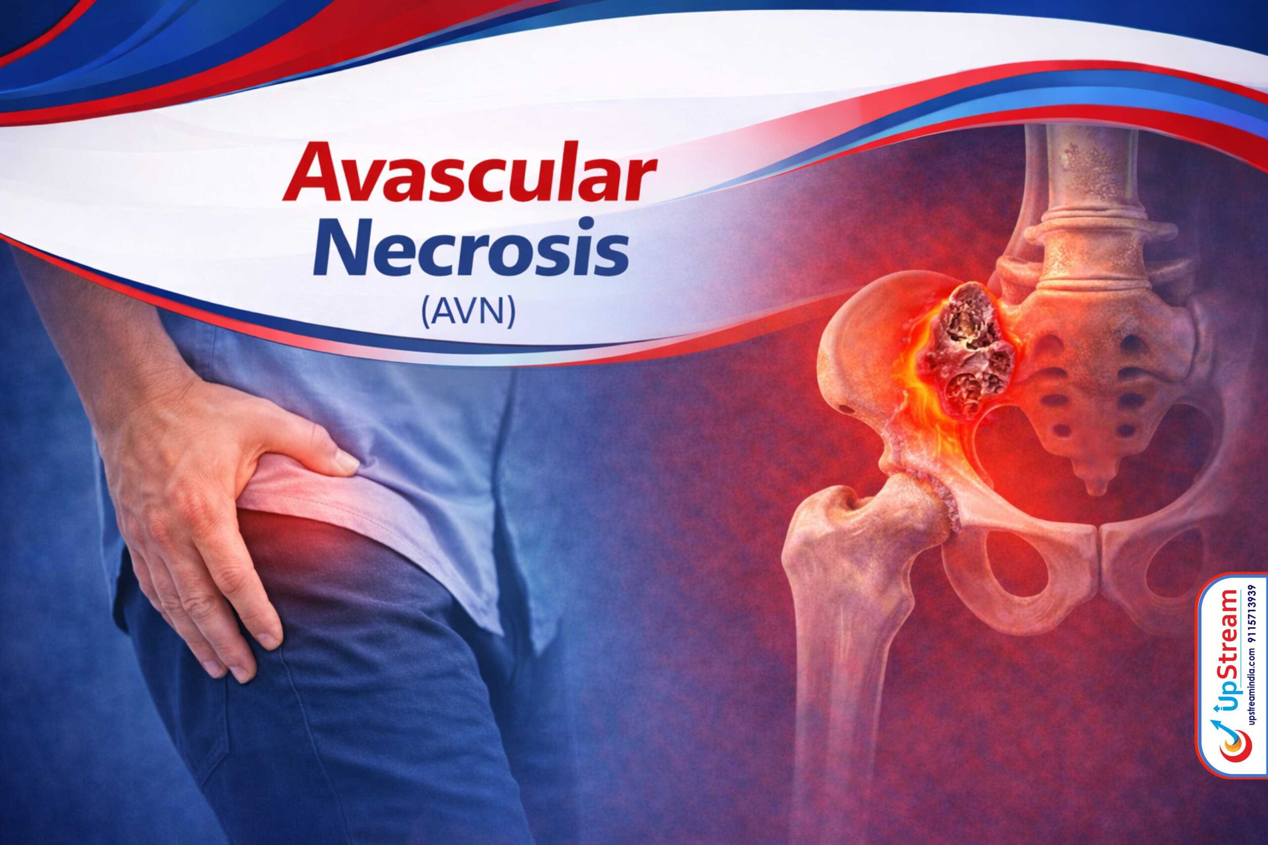 Avascular Necrosis Treatment in Raipur