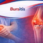 bursitis treatment in raipur