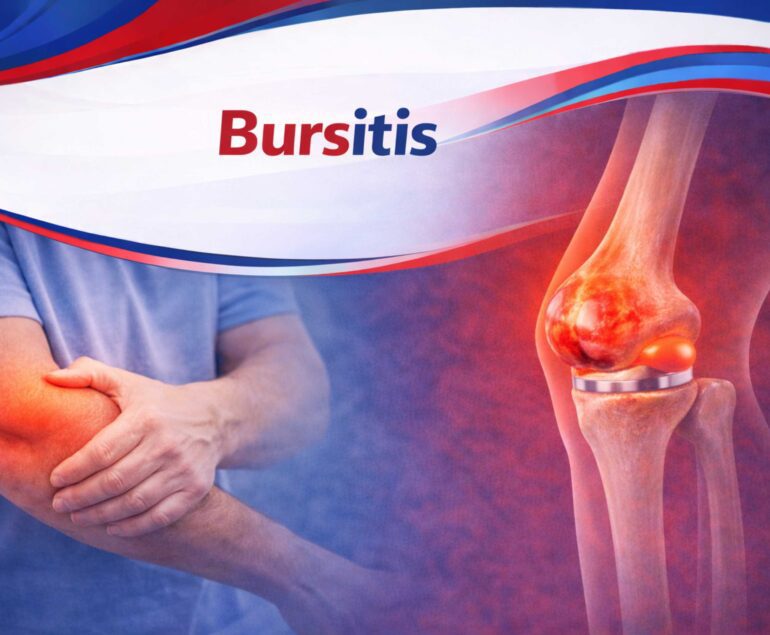 bursitis treatment in raipur