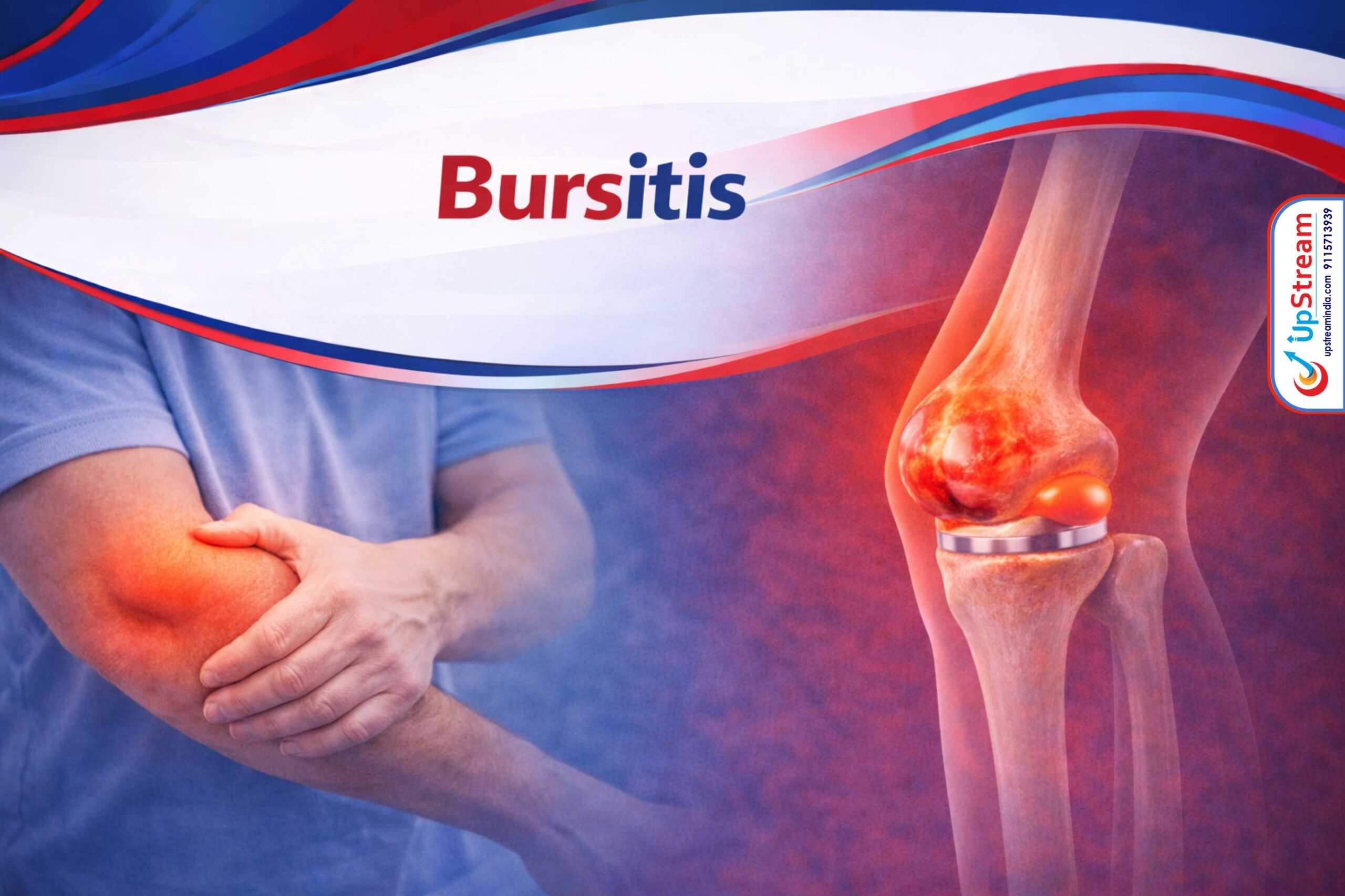 bursitis treatment in raipur