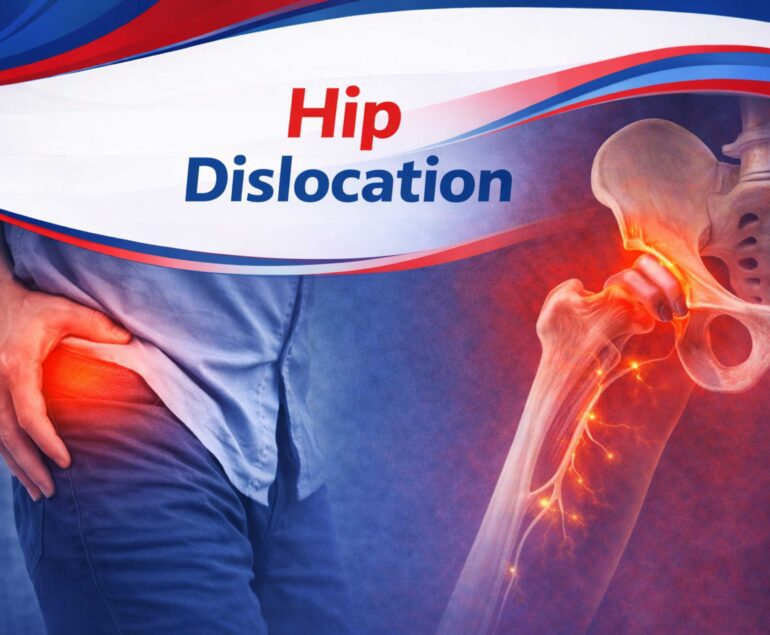 Hip-Dislocation-photo-upstream