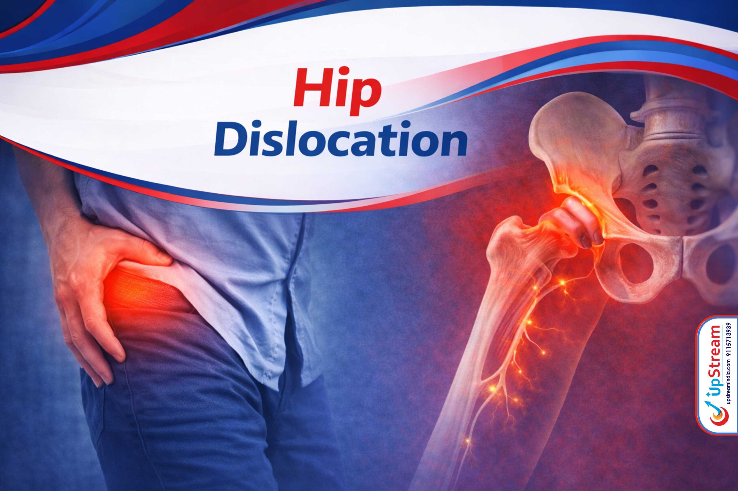 Hip-Dislocation-photo-upstream