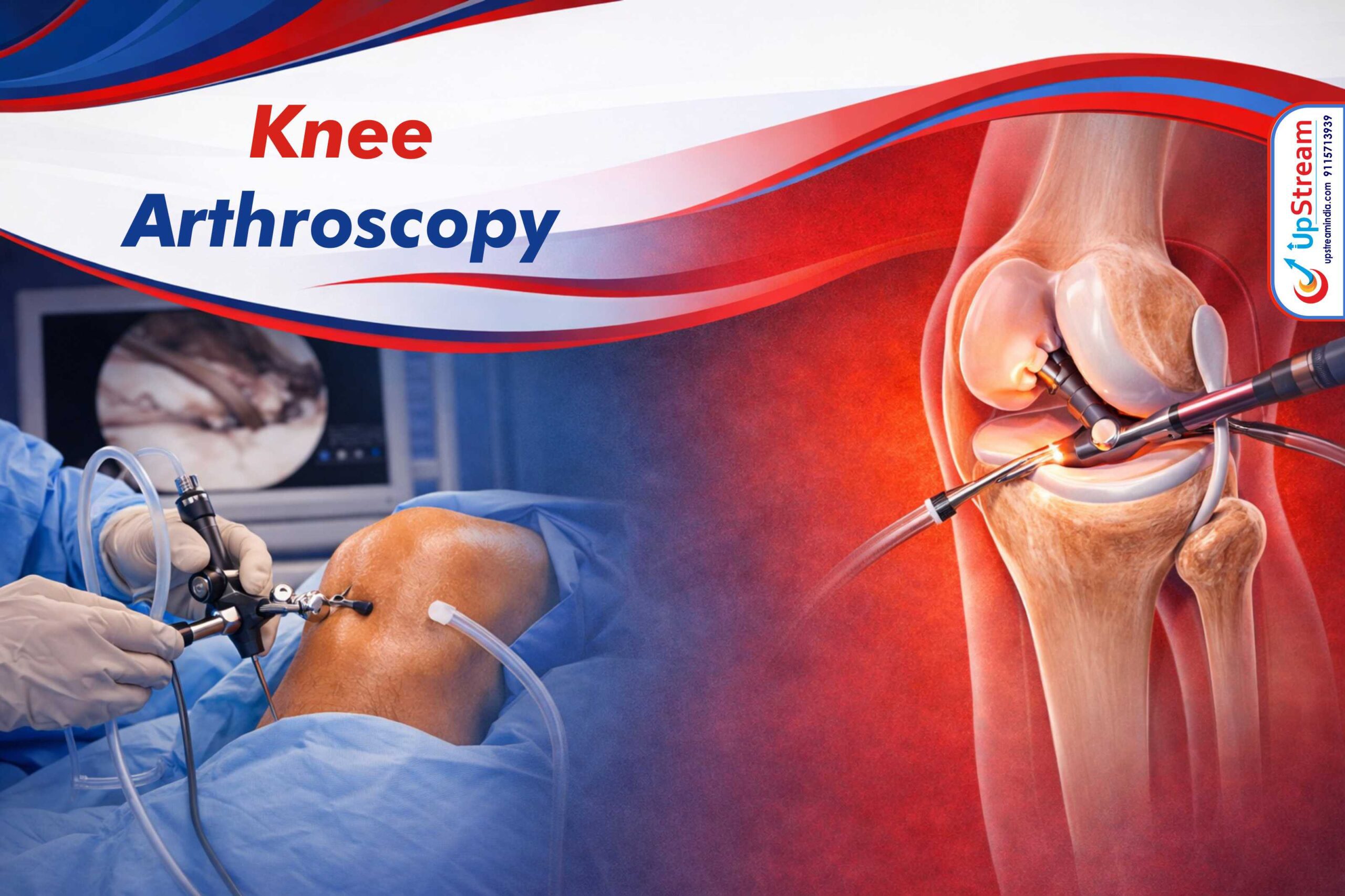 Knee-Arthroscopy-photo-upstream
