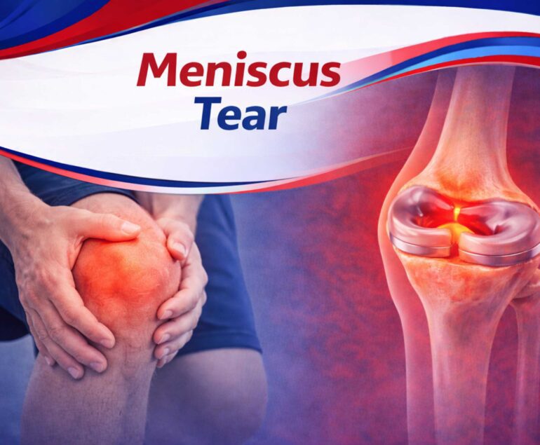 Meniscus Tear Treatment in Raipur – Knee Cartilage Injury Guide by best orthopedic doctor in raipur