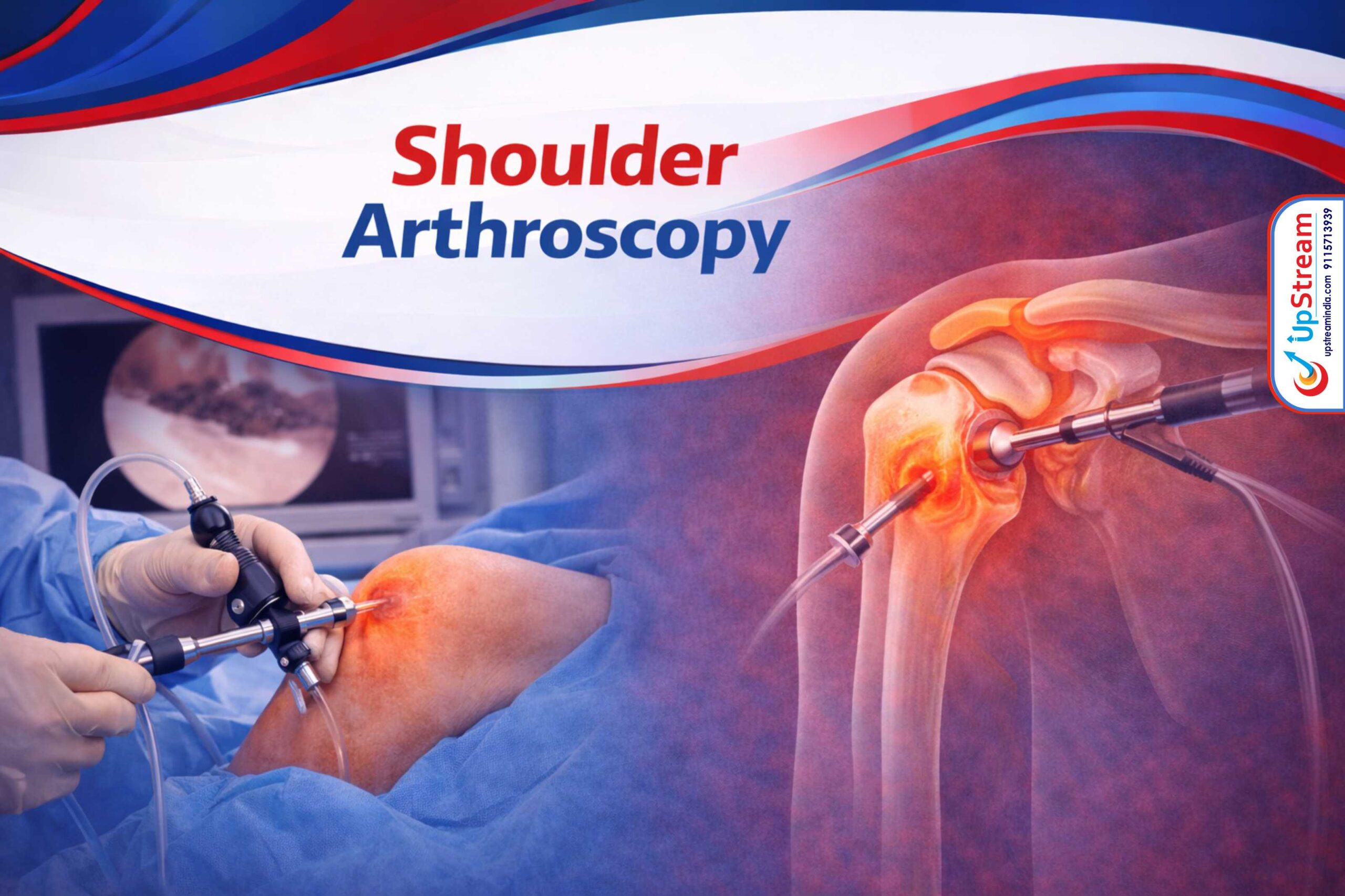 Shoulder Arthroscopy Treatment in Raipur