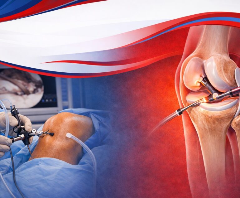 Knee Arthroscopy